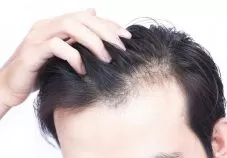 clinics for hair transplant