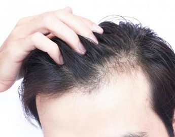 clinics for hair transplant