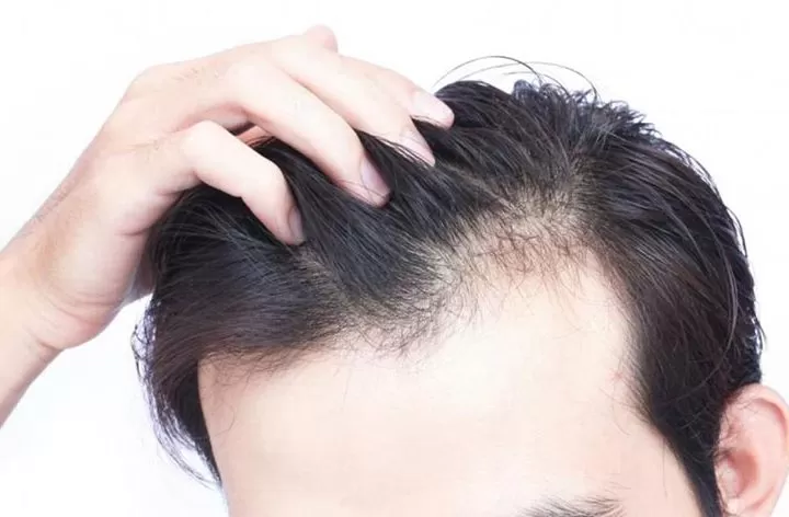 clinics for hair transplant