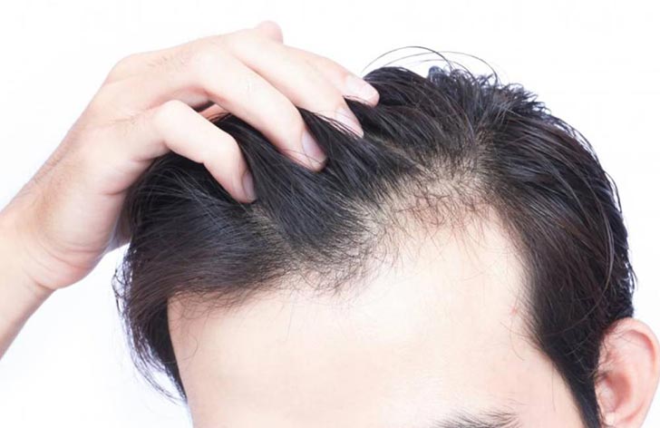 clinics for hair transplant