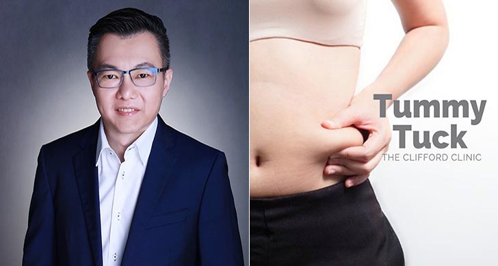 The Clifford Clinic tummy tuck