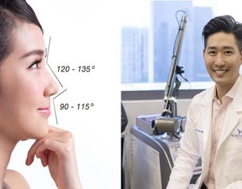 Nose-Thread-Lift singapore