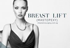 MH-Plastic-Surgery breast lift