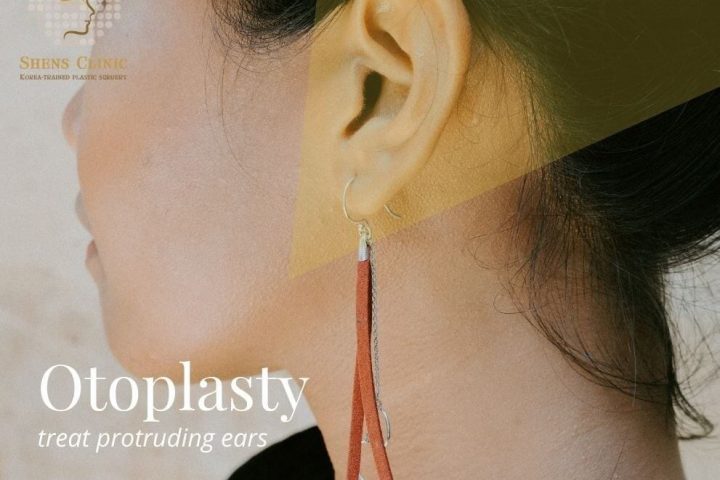 5 Best Clinics in Singapore for Otoplasty (Ear Surgery)