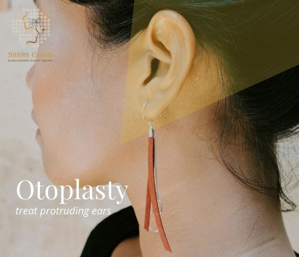 5 Best Clinics in Singapore for Otoplasty (Ear Surgery)