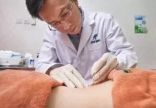 Best Acupuncture Clinics in Singapore