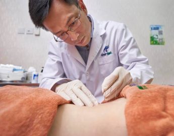 Best Acupuncture Clinics in Singapore