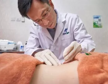 Best Acupuncture Clinics in Singapore