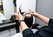 Best Hair Replacement in Singapore