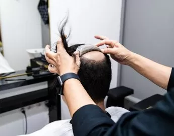 Best Hair Replacement in Singapore