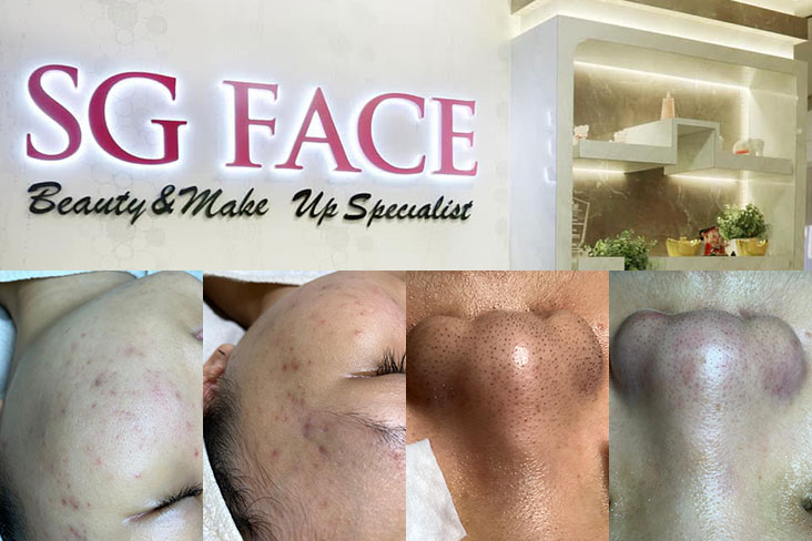 SG Face Review