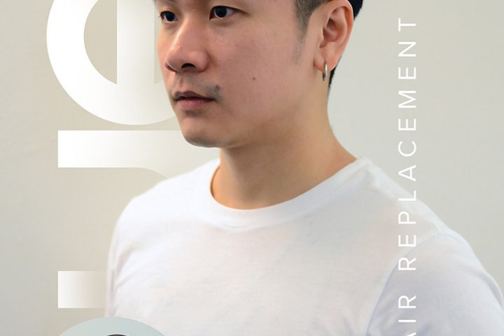 UEC Hair Replacement Review