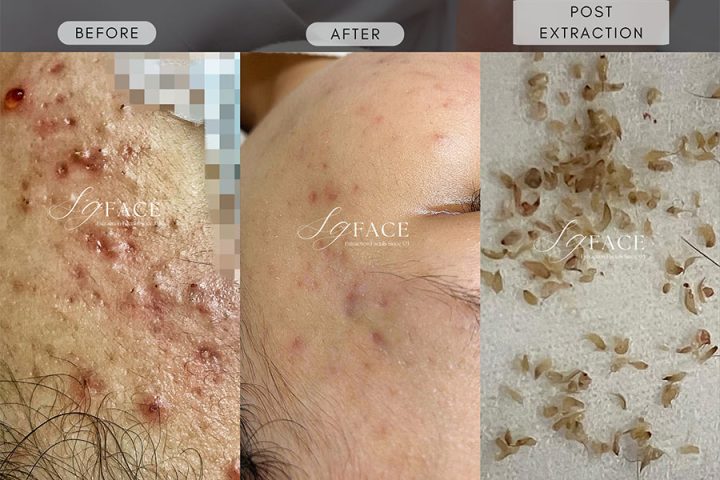 SG-Face-singapore-review