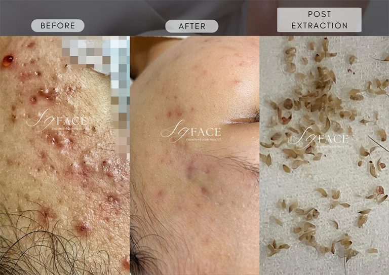 SG-Face-singapore-review